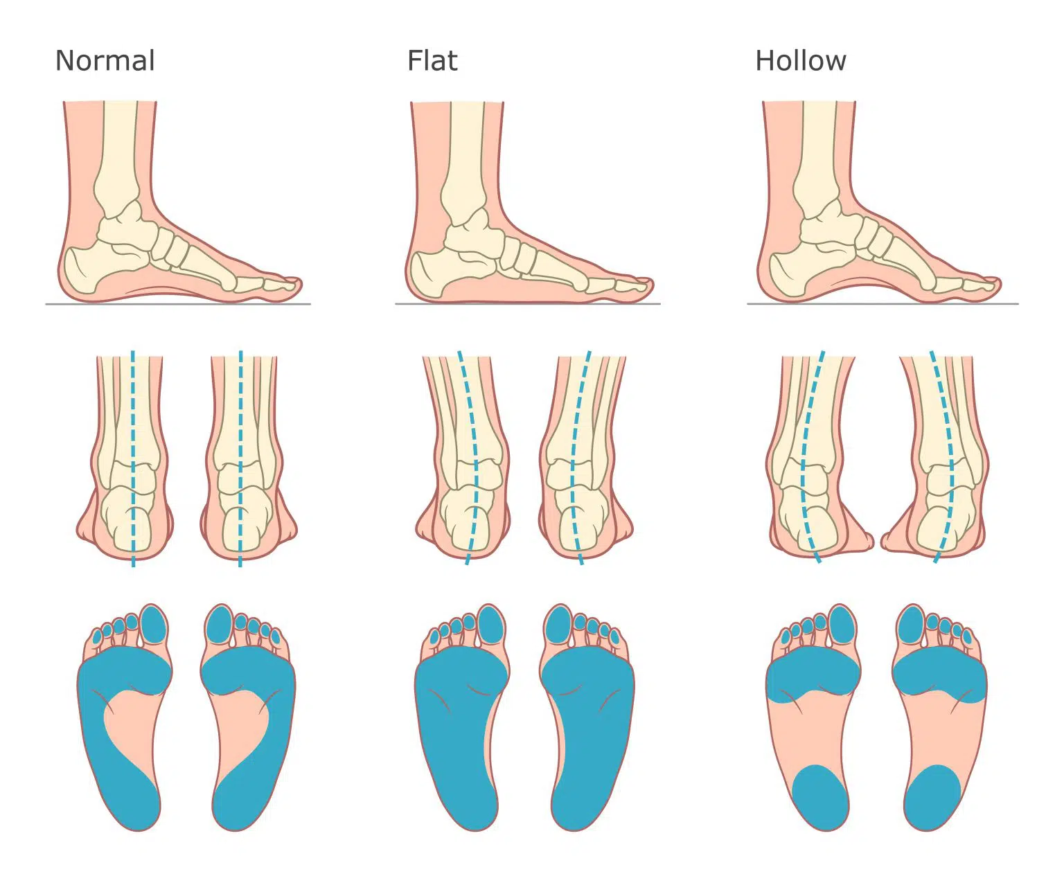 different-postures-1024x870 Hip & Back