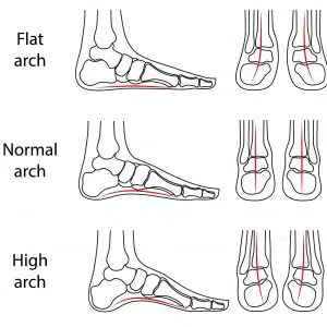 foot-types