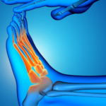 Step by Step ScienceBiomechanical Concepts