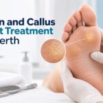 Corn and Callus Foot Treatment in Perth